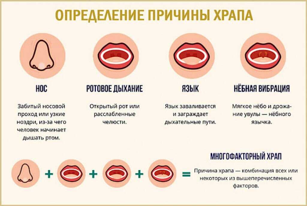 Как не слышать храп другого человека: постараться заснуть или остановить спящего, а также, помогают ли наушники и какие звуки заглушат рулады мужа?