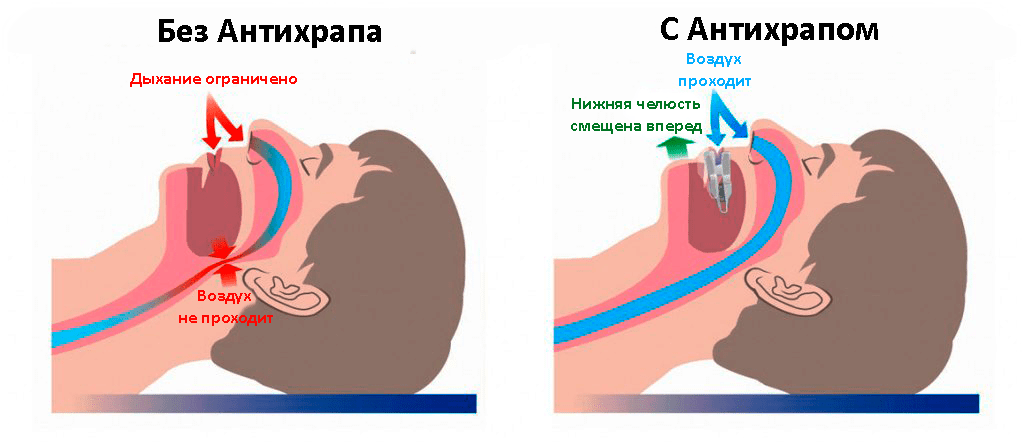 Храп и сопение у грудного ребенка: распространенные причин и 6 способов налаживания сна