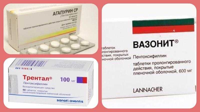 Дешевые аналоги трентала: вазонит или пентоксифиллин, какой заменитель трентала дешевле и лучше, отзывы