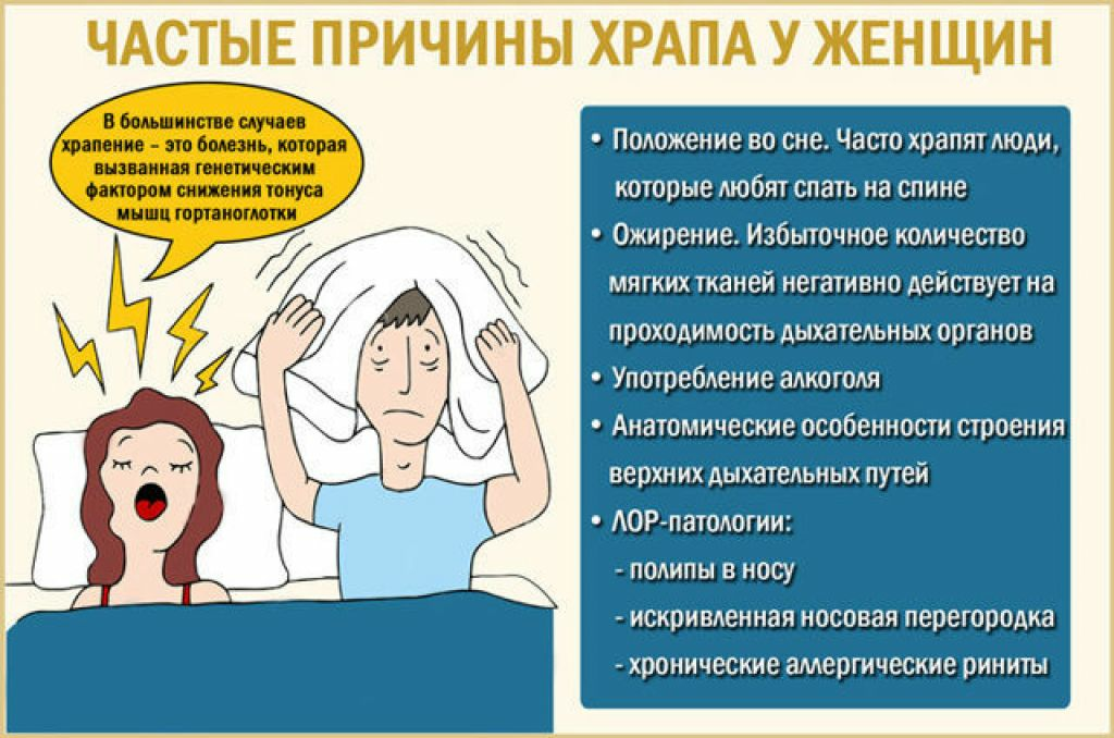 Храп
