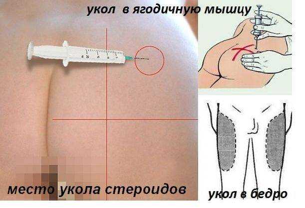 В каком возрасте женщина имеет право на откровенные наряды
